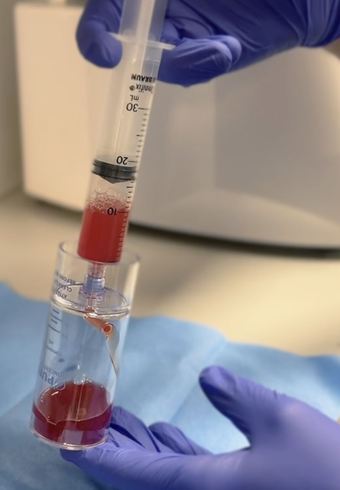 Platelet-rich plasma preparation at Florida Regen